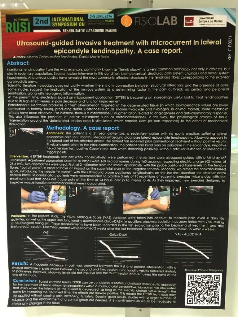 EPTE® en epicondilio Symposium Rusi