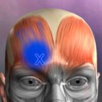 app-per-fisioteapisti-fisiatri-trigger-points