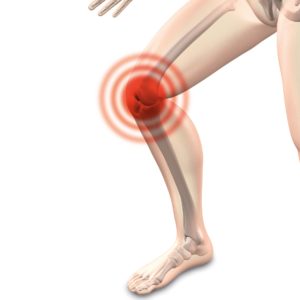 trattamento e prevenzione ginocchio del saltatore