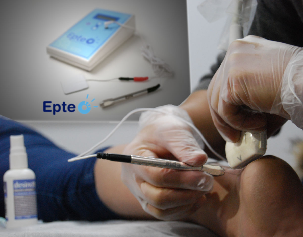 EPTE treatment Achilles tendon course