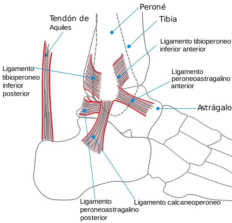 Tendinopatía del tendón de Aquiles, conoce sus causas y el tratamiento Tendinopatía del tendón de Aquiles, conoce sus causas y el tratamiento