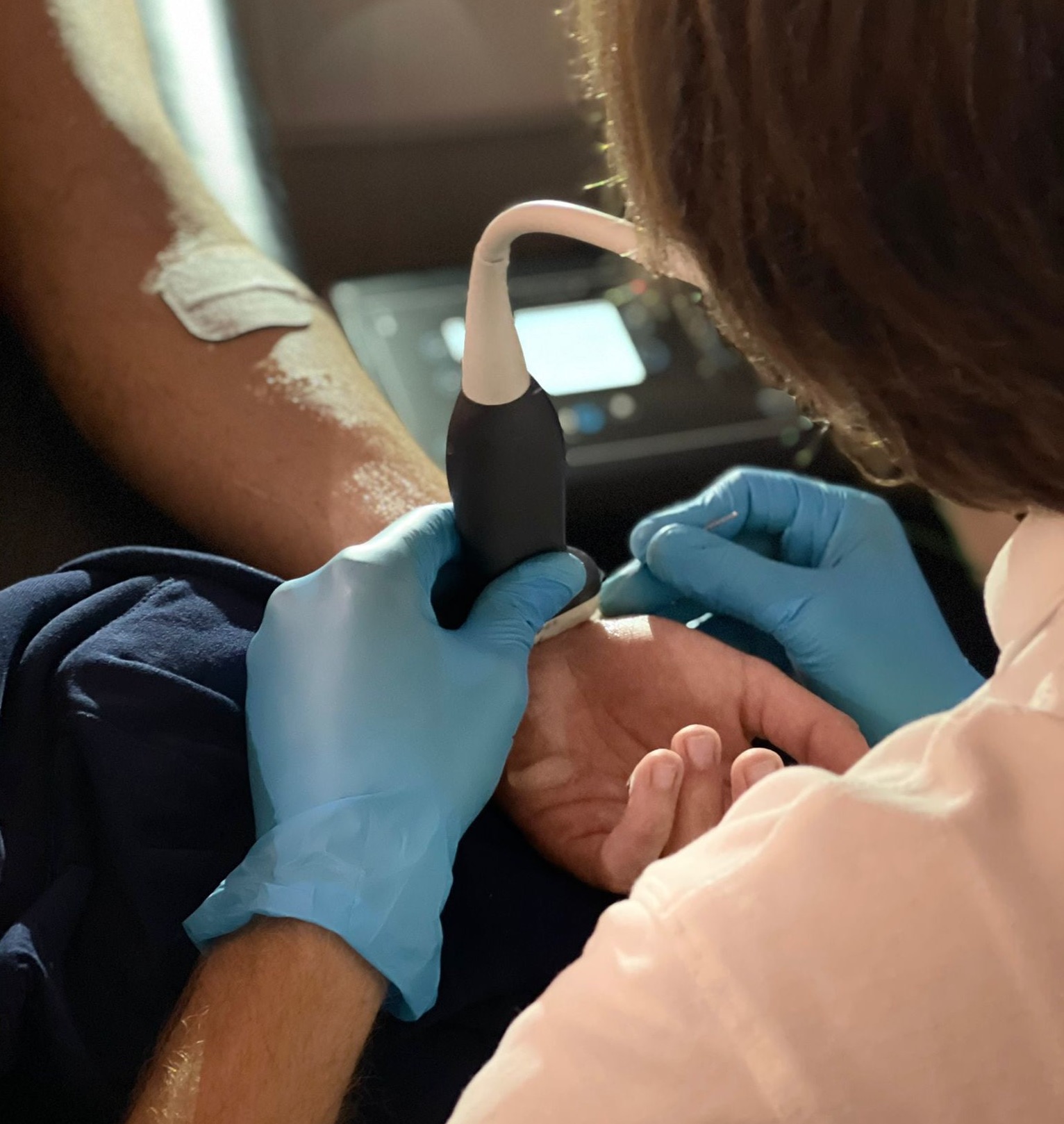 Neuromodulación percutánea Neuromodulación percutánea